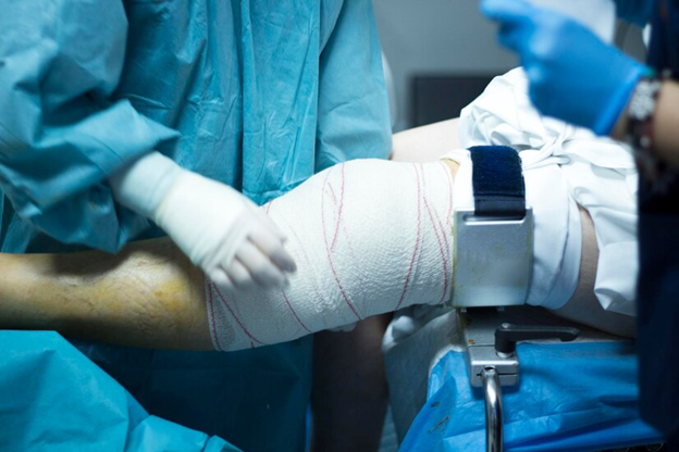 Understanding ACL Surgery: Restoring Stability and Recovery