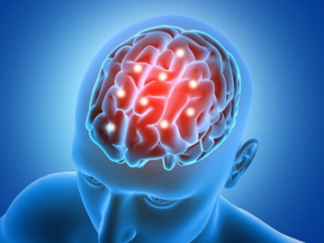 Brain Stroke: What Is It?